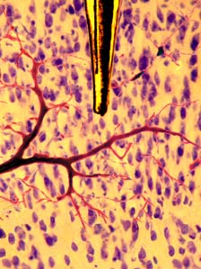 MRI sensor image