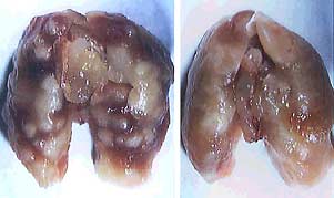 Mouse lungs infected by 2 different TB strains