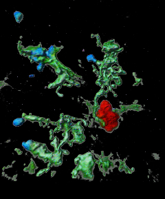 cyst containing toxoplasma gondii