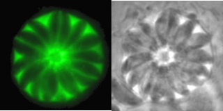 Toxoplasma gondii dividing