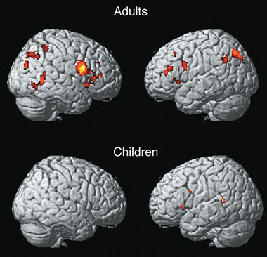 Scans of adult and child brains