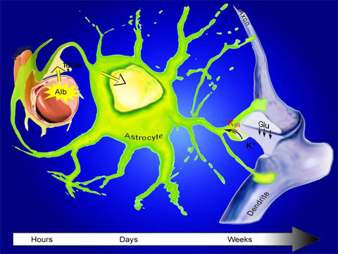 Diagram of neural damage from brain injury